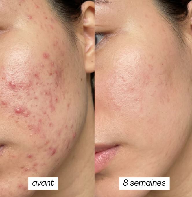 Glow Me ! Pureté & Fraicheur instantanées